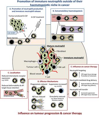 Neutrophil Maturity in Cancer